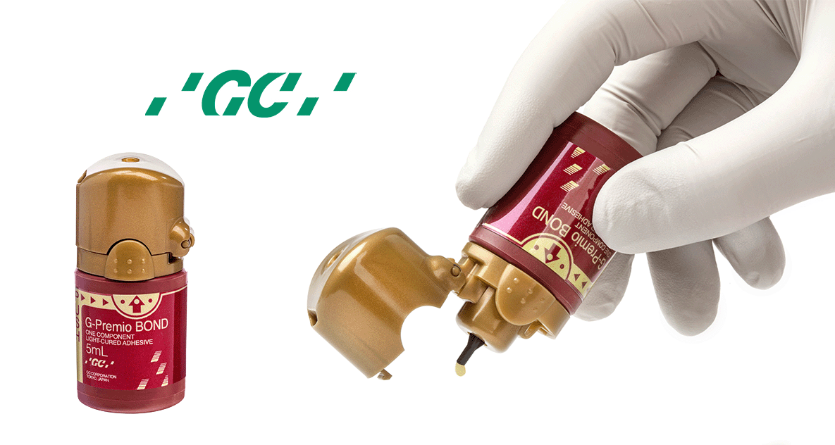 Stick With Us: Big Value, Stronger Bonds with GC’s G-Premio BOND